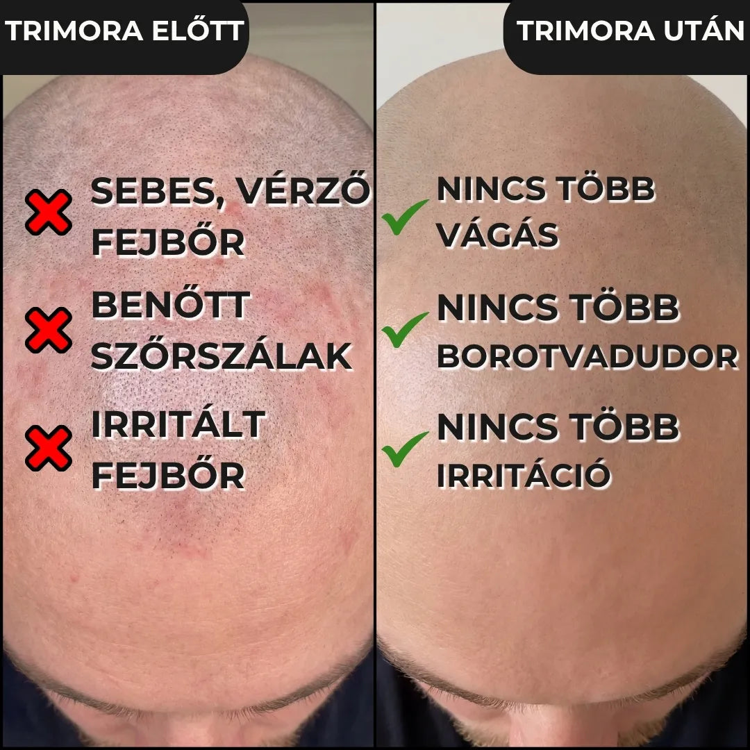 Trimora Start Kezdőcsomag
